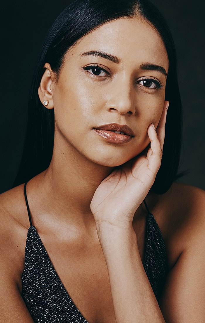 Atlanta Botox & Dermal Fillers model