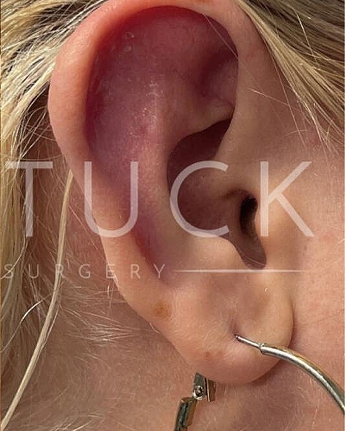 Close-up of an ear with jewelry.