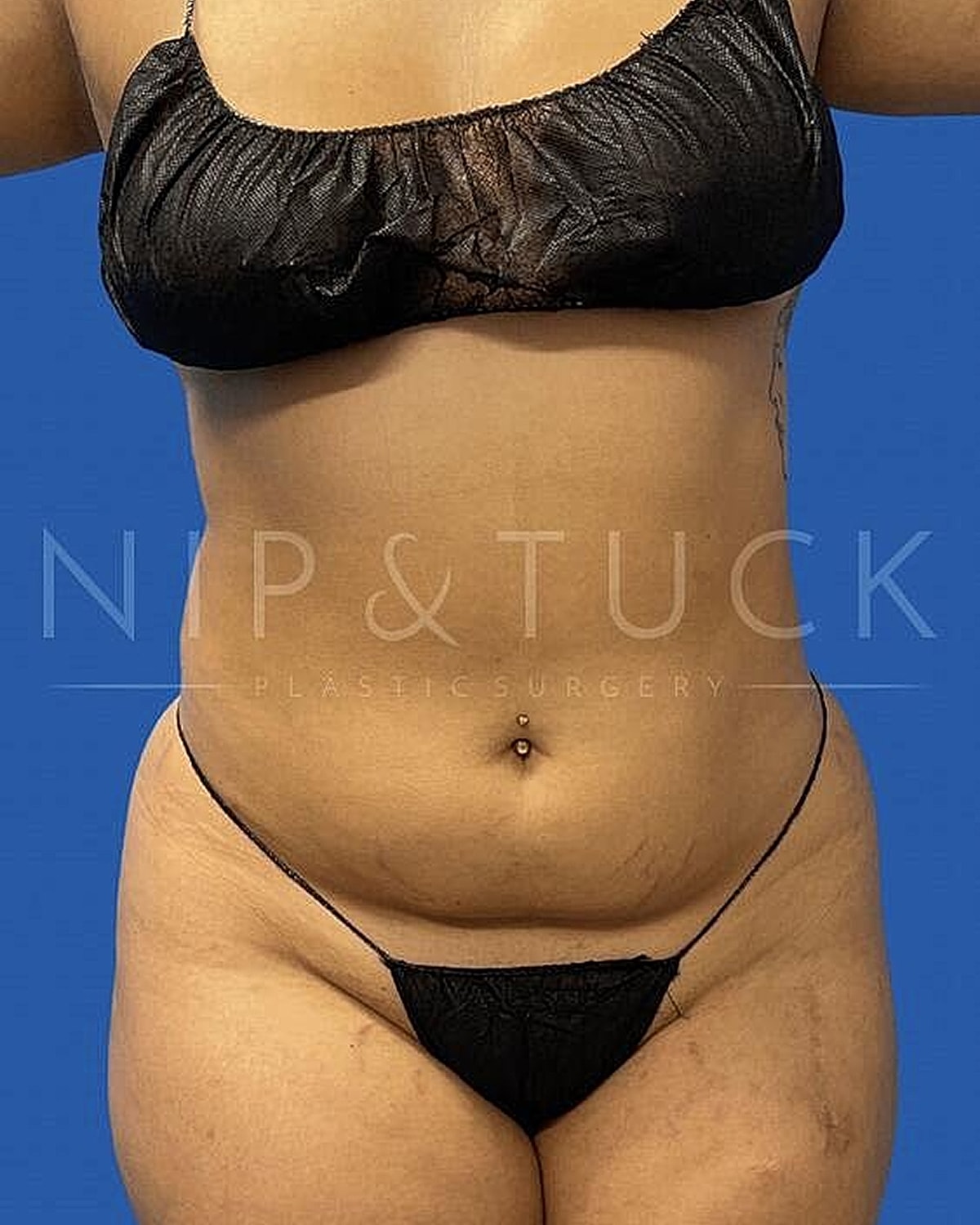 Model in black lingerie, showcasing body shape.