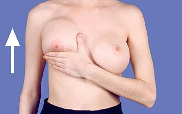 Breast self-exam technique demonstration.